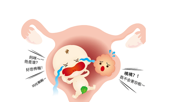 泰国试管婴儿子宫肌瘤